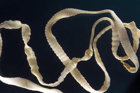 how common are tapeworms in china